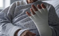 Fratura de Colles: Entendendo a Lesão Comum no Punho